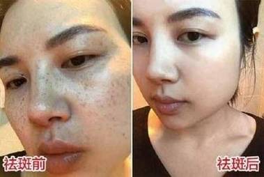 2025年斑点池价格-图3