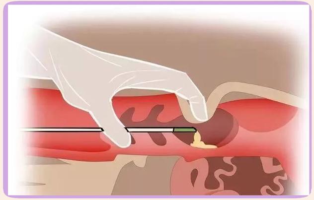 哪里能学牛人工授精技术？-图3